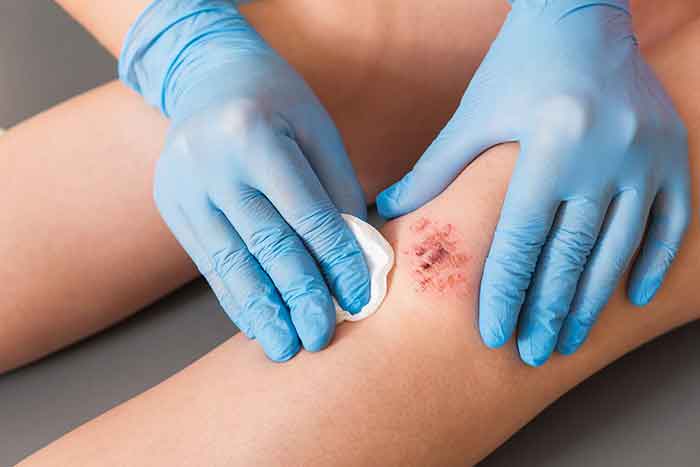 spanisheyeclinic